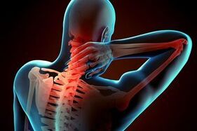 Osteochondroza cervicală
